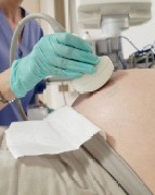 子宮內(nèi)膜異位癥的基礎(chǔ)與臨床研究