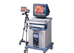 法國(guó)電子數(shù)碼陰道鏡