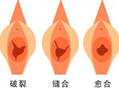 焦作處女膜修補(bǔ)手術(shù)哪家醫(yī)院好